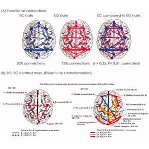 Electroencephalography and brain functional connectivity