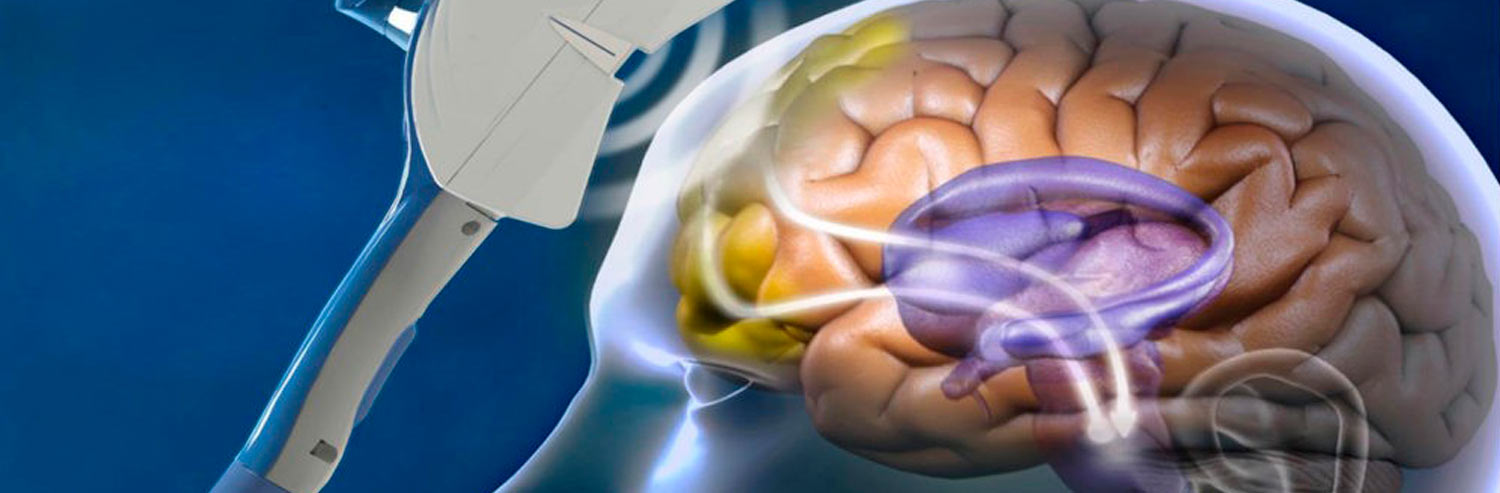 Uso de Estimulación Magnética Transcraneal en Logopedia