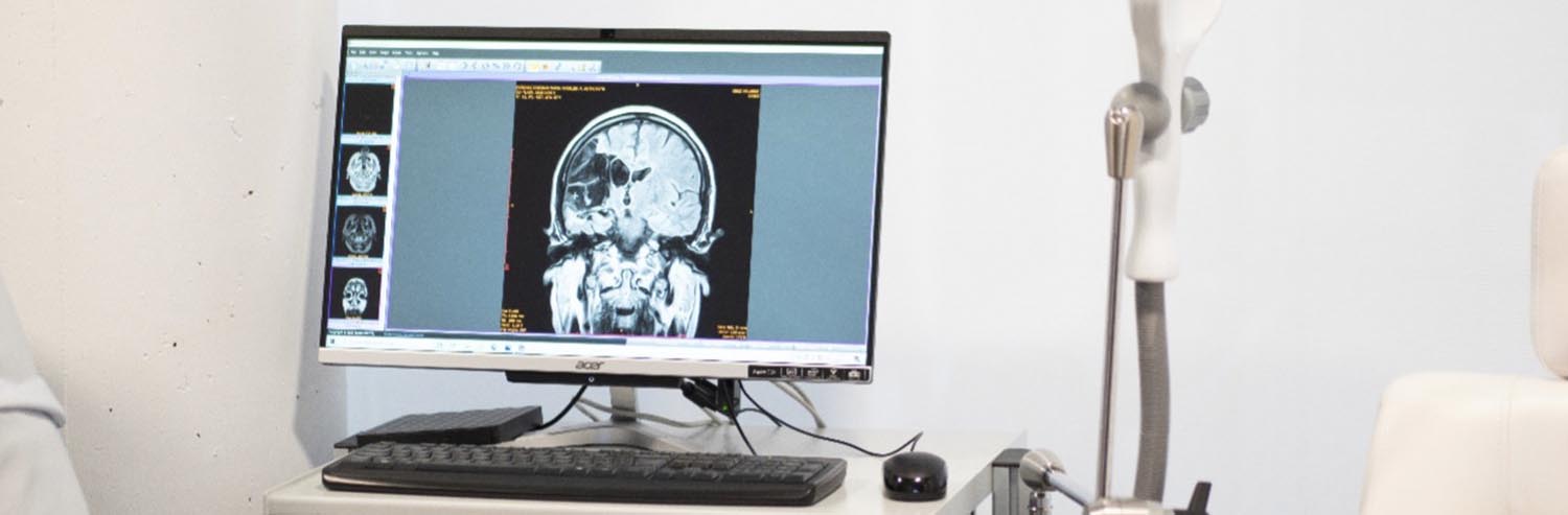 Estimulación Magnética Transcraneal en el Centro Europeo de Neurociencias