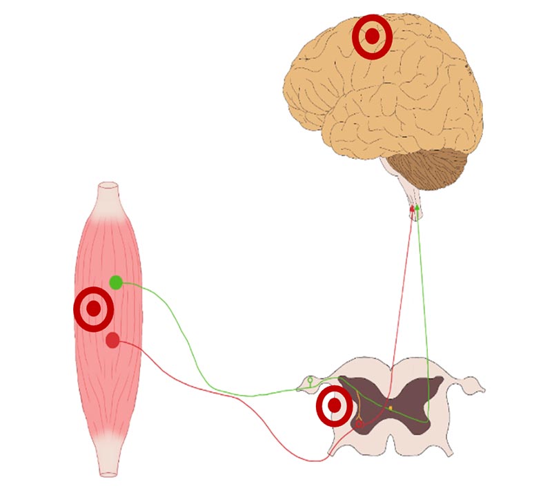 Principios de la neuroplasticidad 