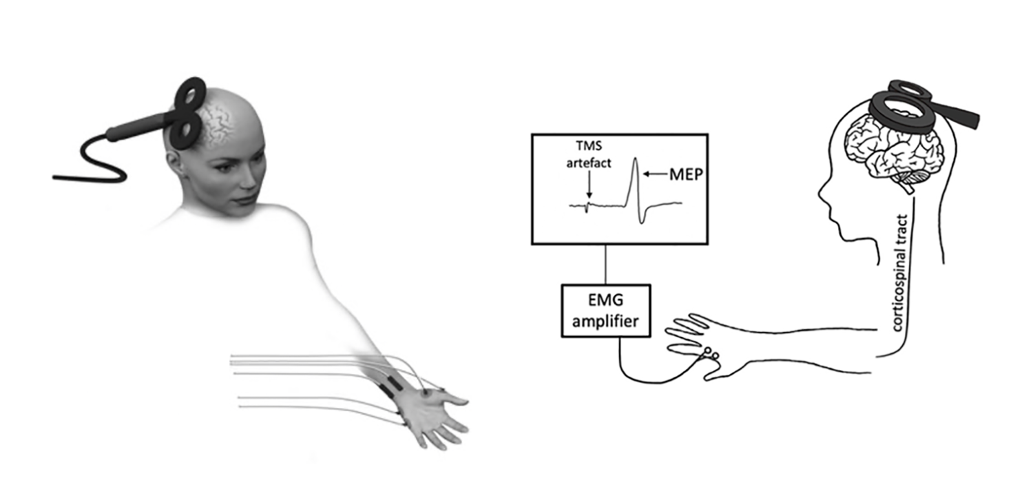 Estimulación pareada en el centro europeo de neurociencias 